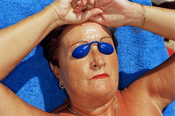 Foto de Martin Parr mujer tomando el sol con parche en el ojo